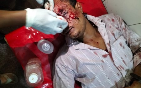 गोली मारकर सर्राफ़ा व्यापारी से 10 लाख की लूट, व्यापारी की हालत गंभीर