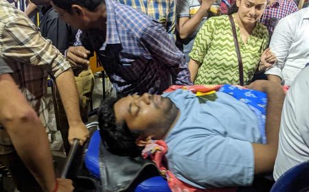 जूनियर डॉक्टर अनिकेत महतो की हालत गंभीर, आरजी कर अस्पताल के सीसीयू में भर्ती