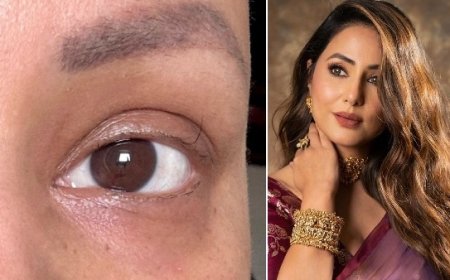 कैंसर से जूझ रहीं हिना खान, पलक तक के बाल झड़े