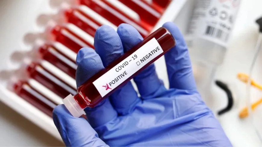 Maharashtra Records Second-Highest COVID-19 Cases as India Logs 257 Active Patients